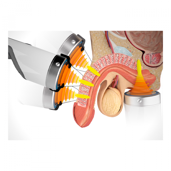 Модульный аппарат для ударно-волновой терапии Duolith SD1 ultra-4