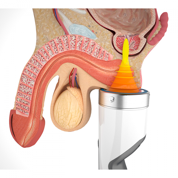 Модульный аппарат для ударно-волновой терапии Duolith SD1 ultra-5