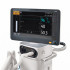 Аппарат ИВЛ Mindray SynoVent SV800