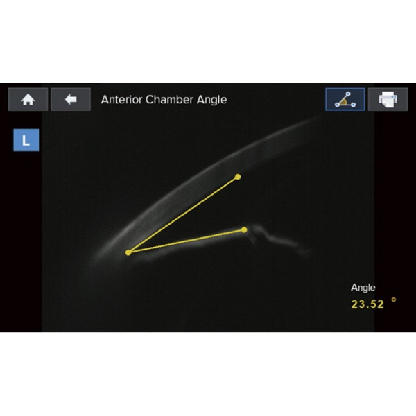 Бесконтактный тонометр глазного давления Huvitz HNT-1 и HNT-1P-5